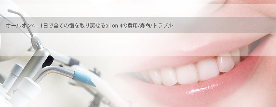 オールオン4 – 1日で全ての歯を取り戻せるall on 4の費用/寿命/トラブル